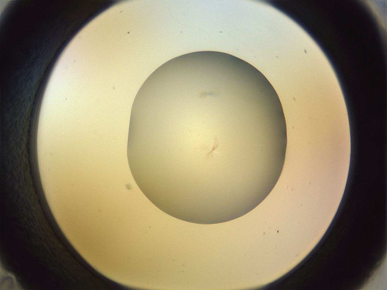 folderID504_plateID1504_batchID5871_wellNum35_profileID1_d1_r95571_ef.jpg