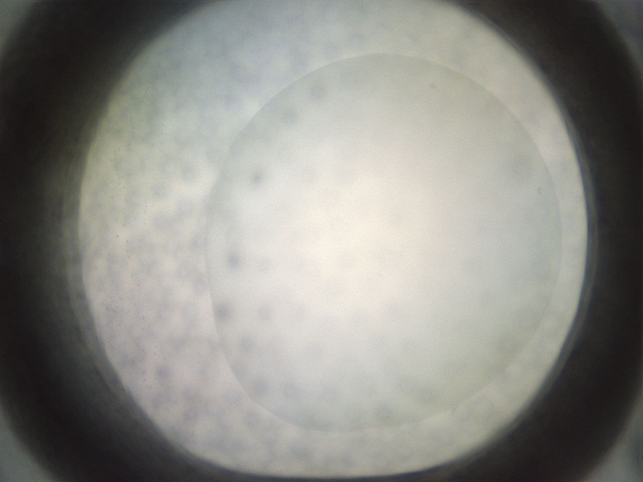 folderID506_plateID2506_batchID12090_wellNum55_profileID1_d1_r188690_ef.jpg