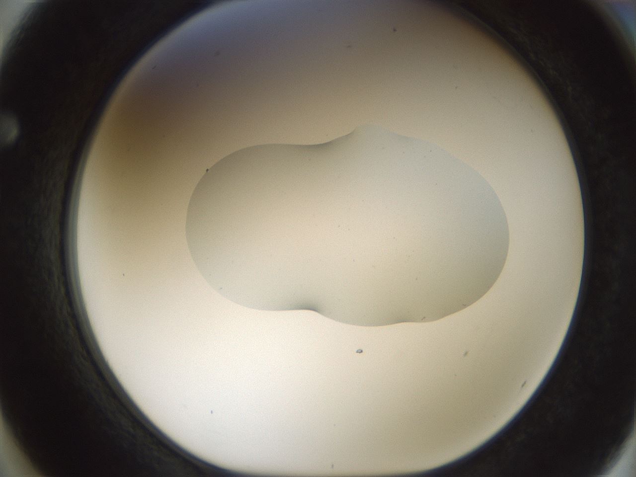 folderID510_plateID1510_batchID5851_wellNum62_profileID1_d1_r95694_ef.jpg