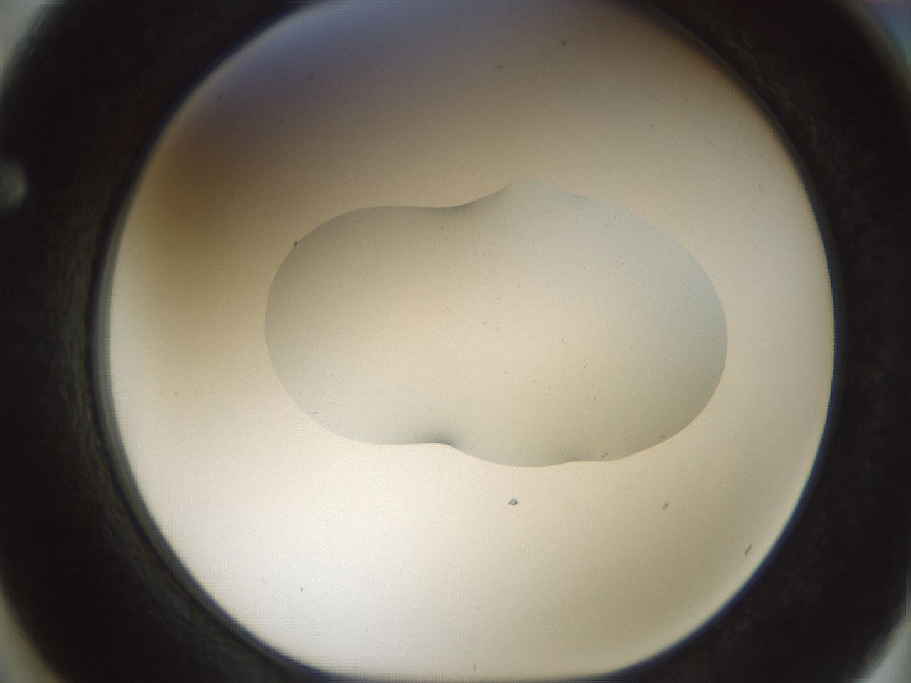 folderID510_plateID1510_batchID5873_wellNum62_profileID1_d1_r95694_ef.jpg
