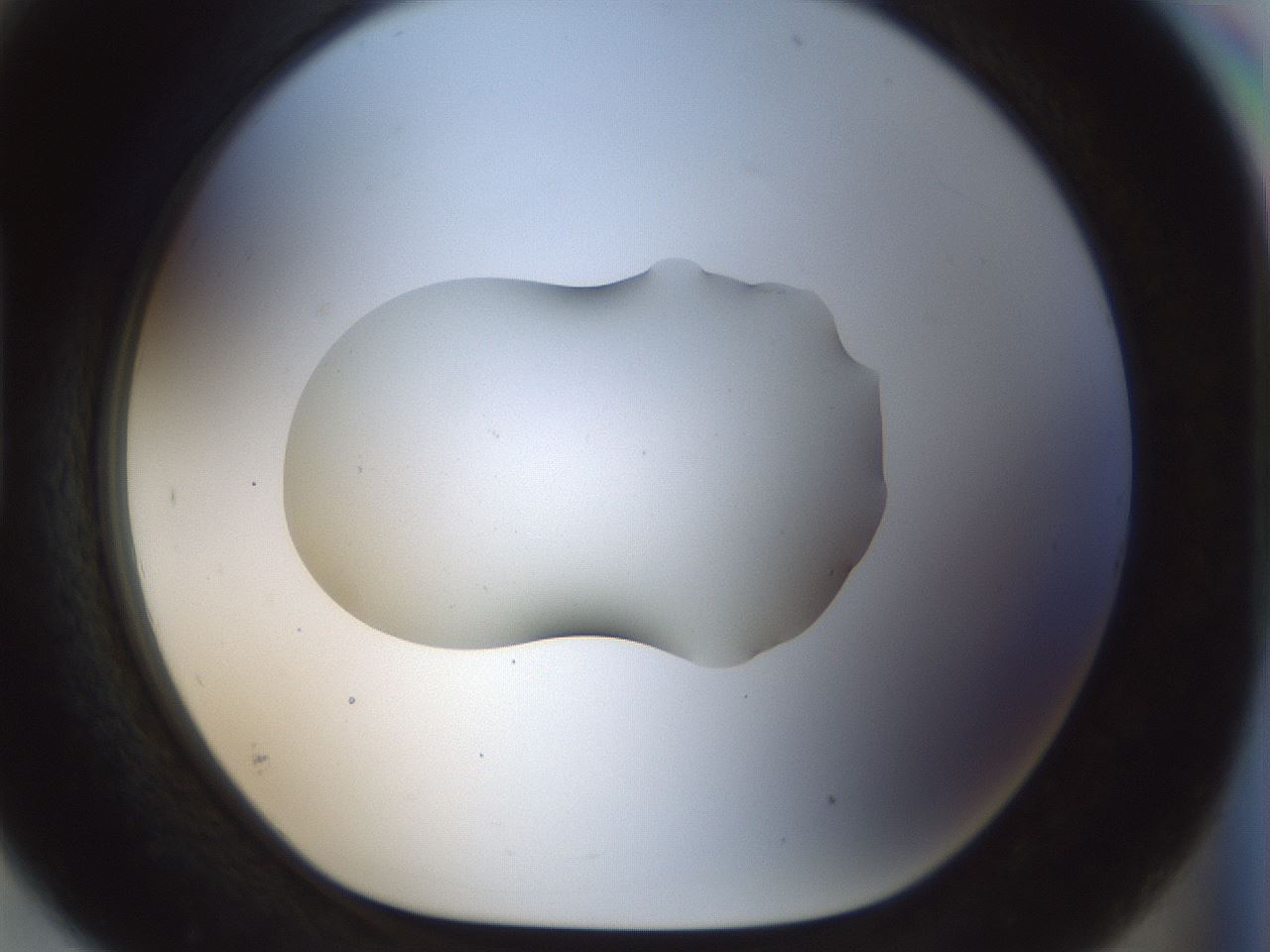 folderID510_plateID1510_batchID5851_wellNum93_profileID1_d1_r95725_ef.jpg