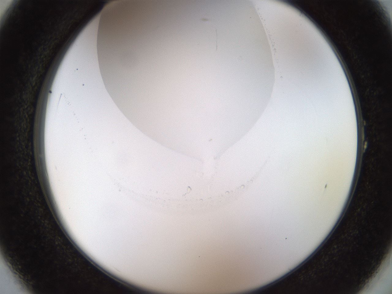 folderID515_plateID1515_batchID5948_wellNum1_profileID1_d2_r96402_ef.jpg