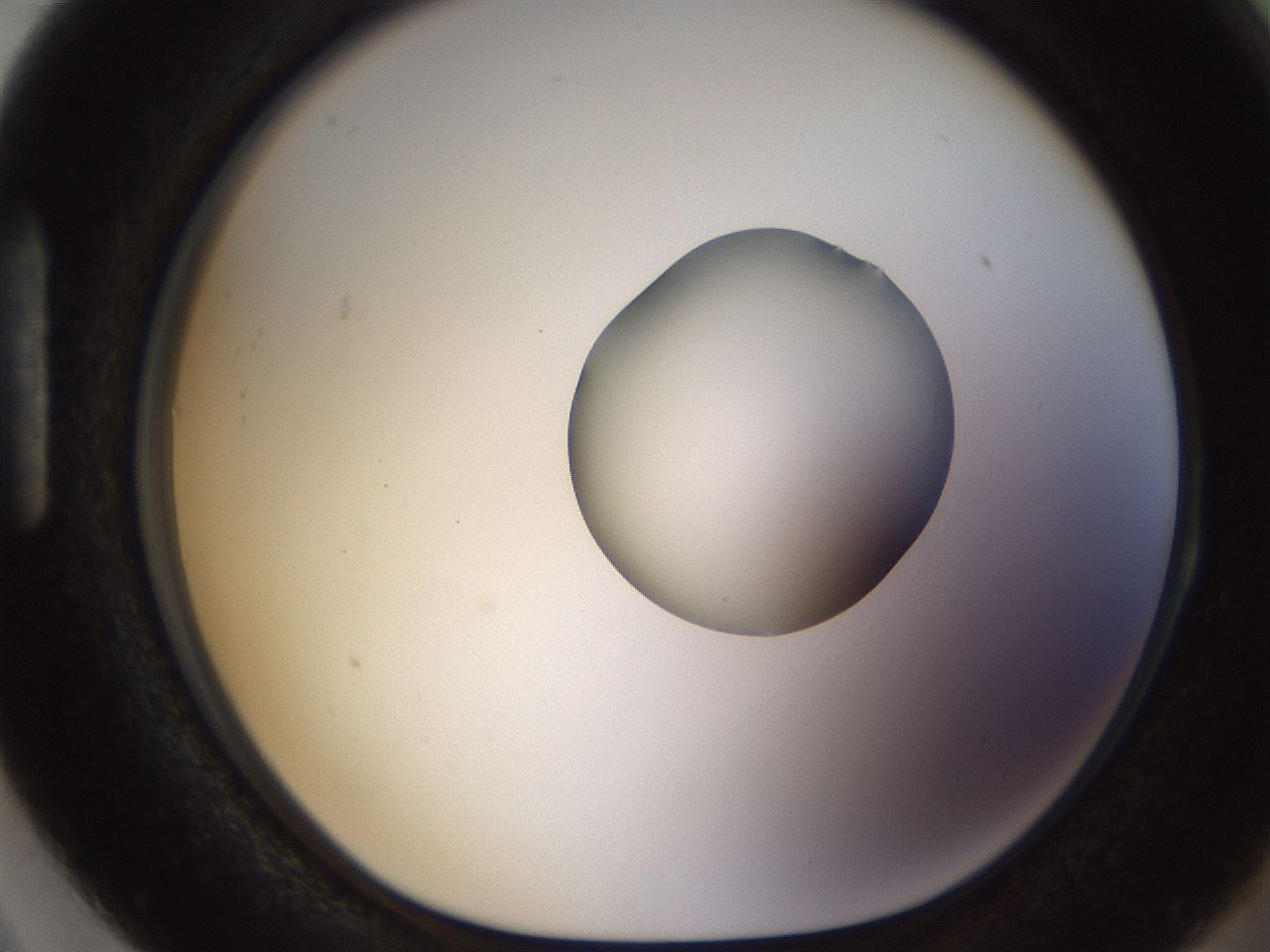 folderID511_plateID1511_batchID5941_wellNum87_profileID1_d1_r95815_ef.jpg