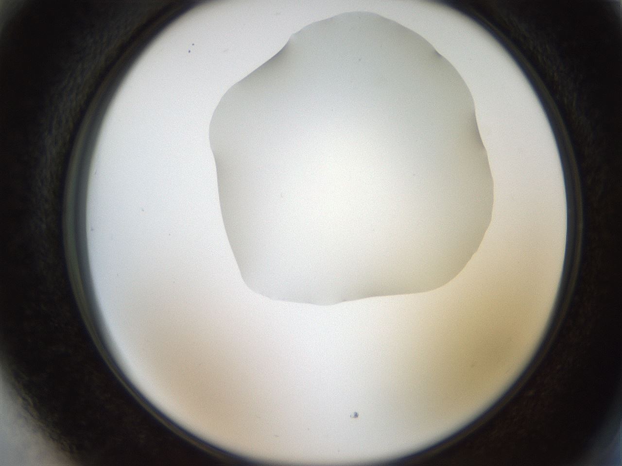 folderID515_plateID1515_batchID5948_wellNum89_profileID1_d2_r96578_ef.jpg