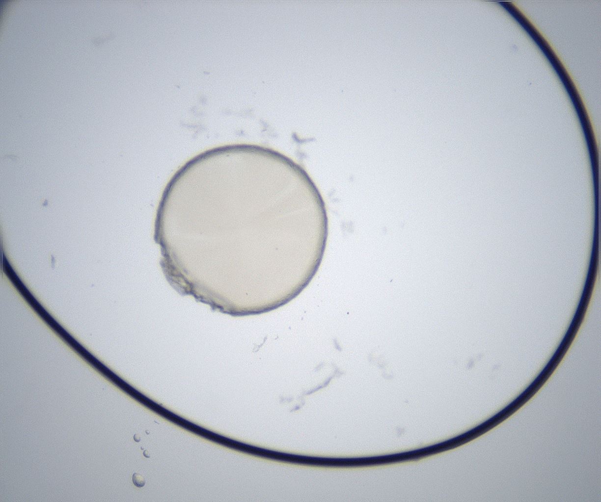 folderID514_plateID2514_batchID12479_wellNum33_profileID1_d1_r189660_ef.jpg