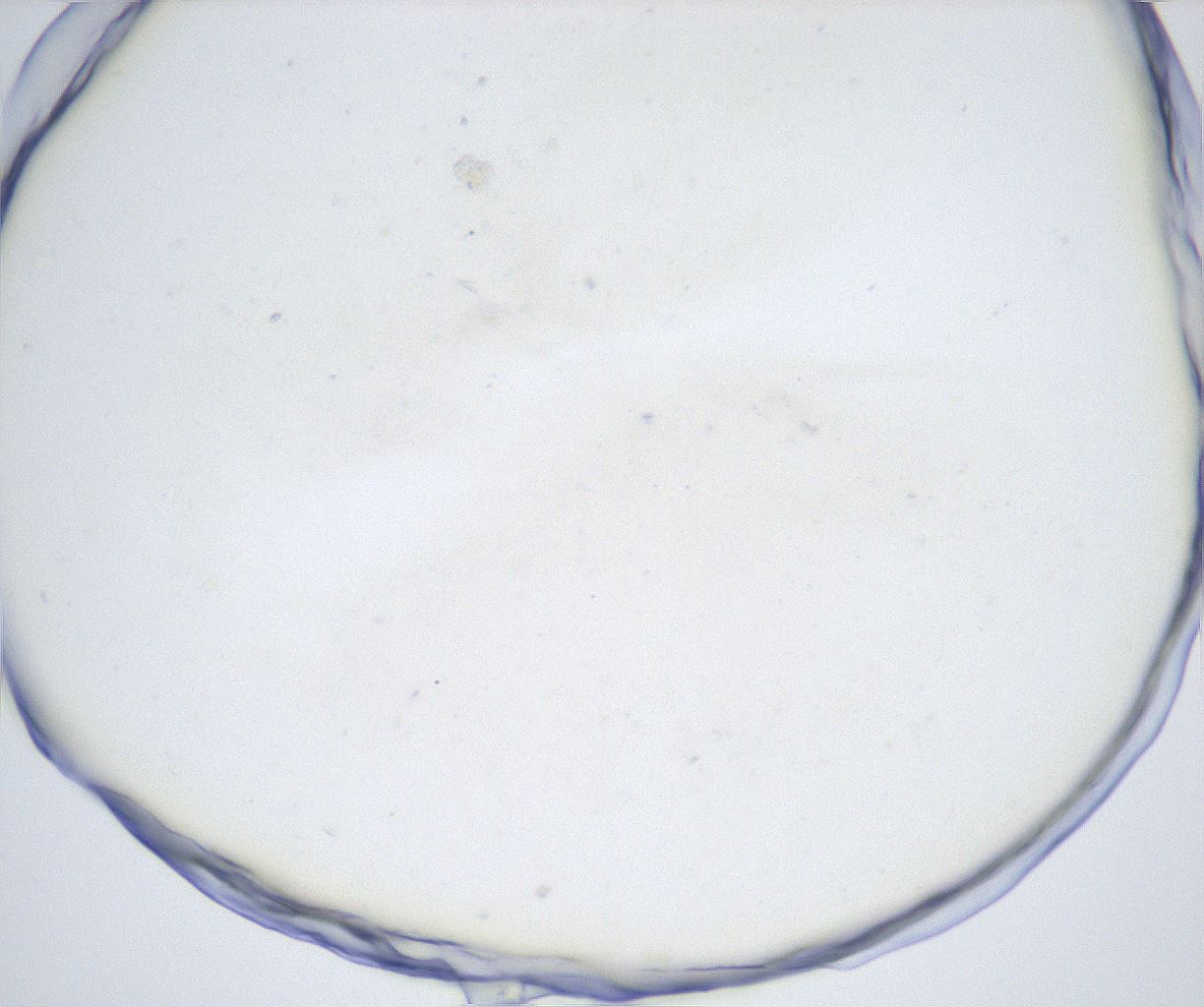folderID515_plateID2515_batchID12484_wellNum14_profileID1_d1_r190966_ef.jpg