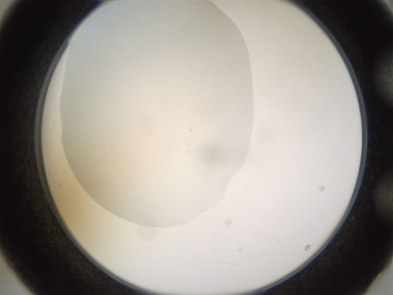 folderID520_plateID1520_batchID5989_wellNum21_profileID1_d2_r97402_ef.jpg