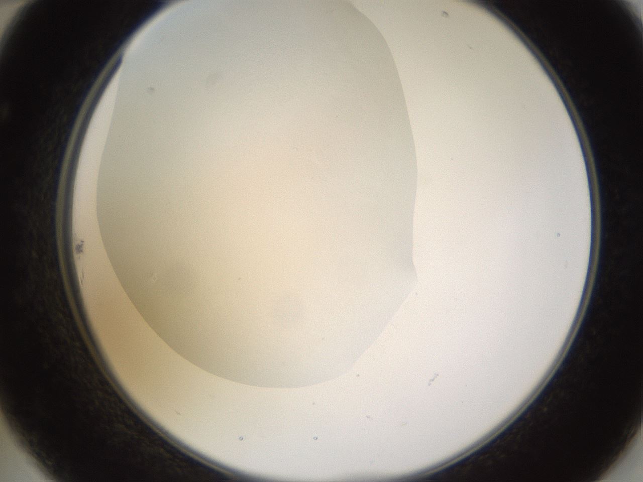 folderID520_plateID1520_batchID5989_wellNum22_profileID1_d2_r97404_ef.jpg