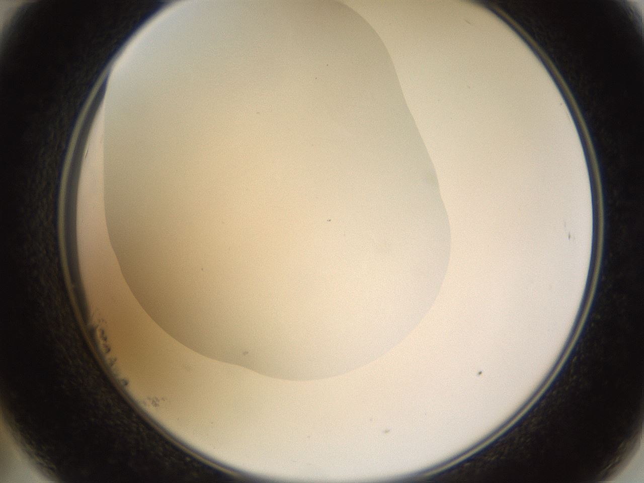 folderID520_plateID1520_batchID5989_wellNum23_profileID1_d2_r97406_ef.jpg