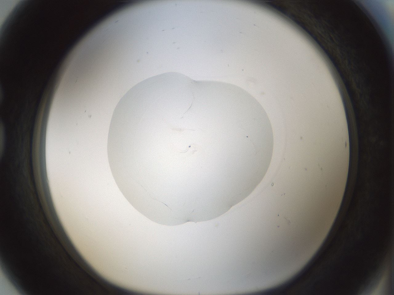 folderID522_plateID1522_batchID6126_wellNum80_profileID1_d1_r97824_ef.jpg