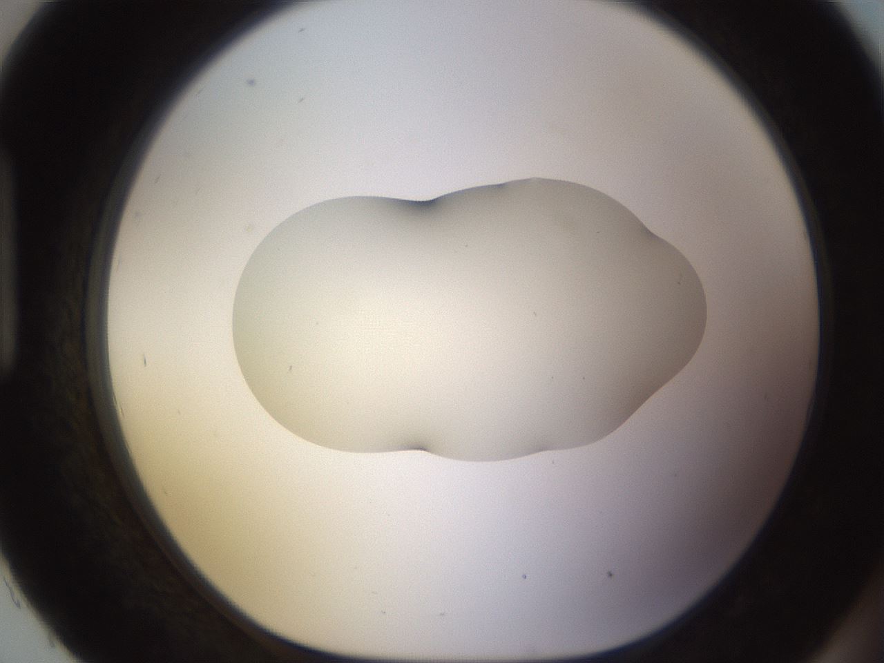 folderID530_plateID1530_batchID6231_wellNum93_profileID1_d1_r98749_ef.jpg