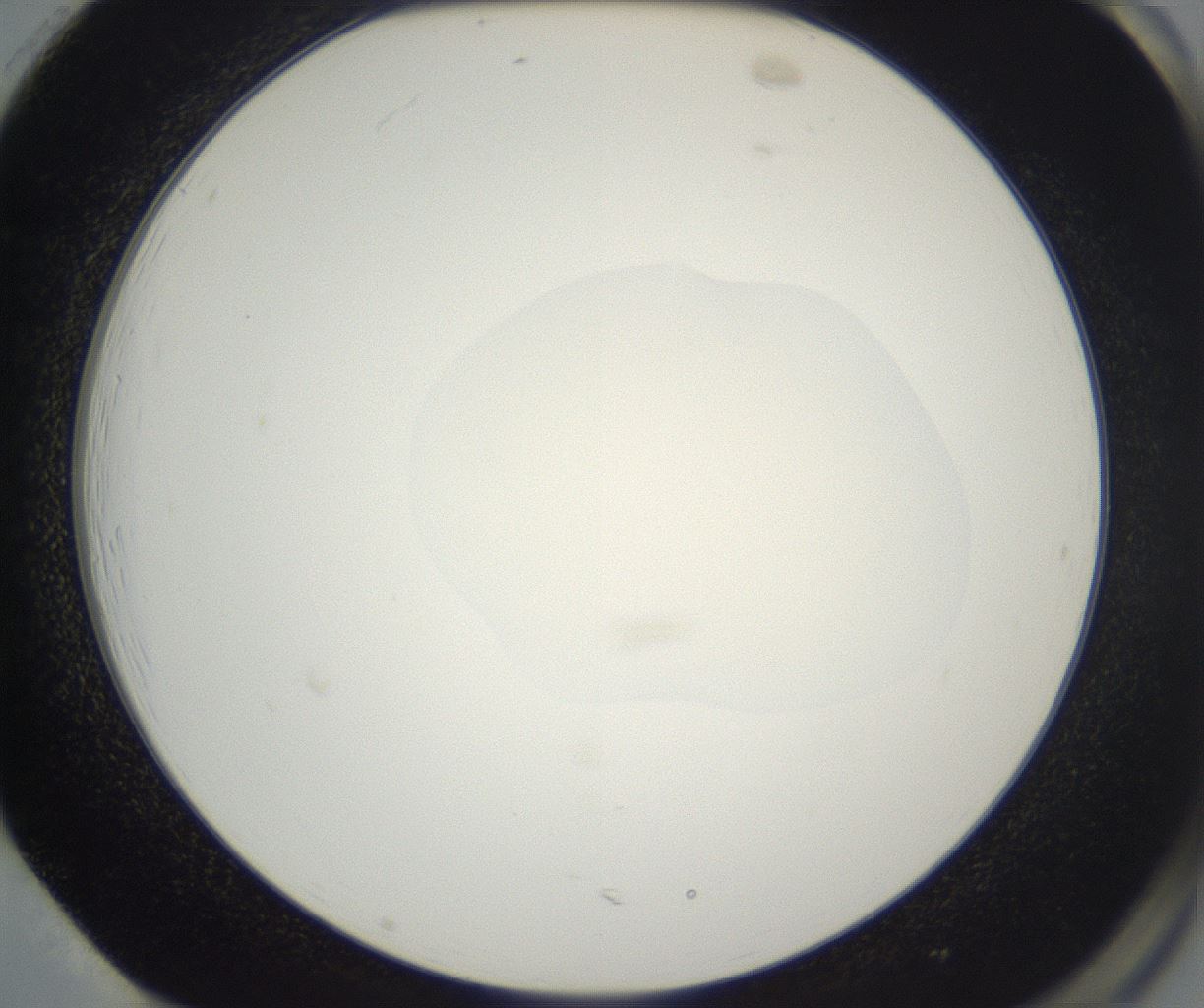folderID530_plateID2530_batchID12530_wellNum85_profileID1_d2_r191309_ef.jpg