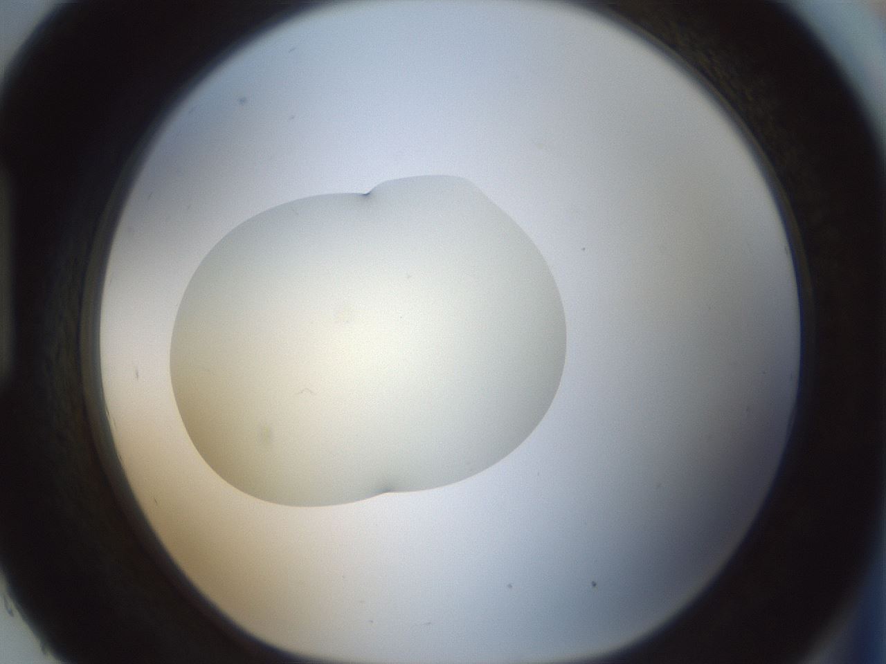 folderID536_plateID1536_batchID6248_wellNum93_profileID1_d1_r99622_ef.jpg
