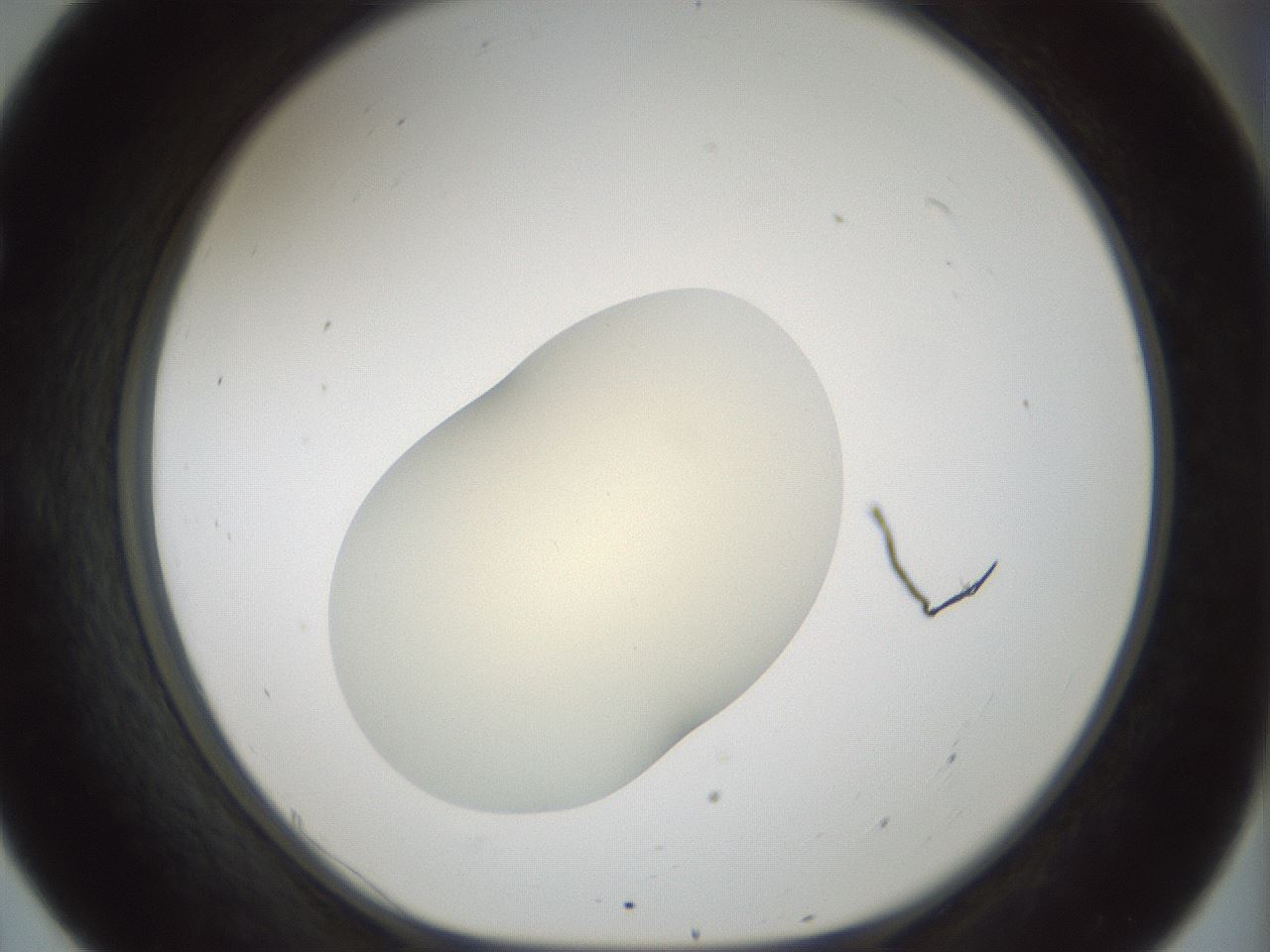 folderID541_plateID1541_batchID6247_wellNum55_profileID1_d1_r99488_ef.jpg