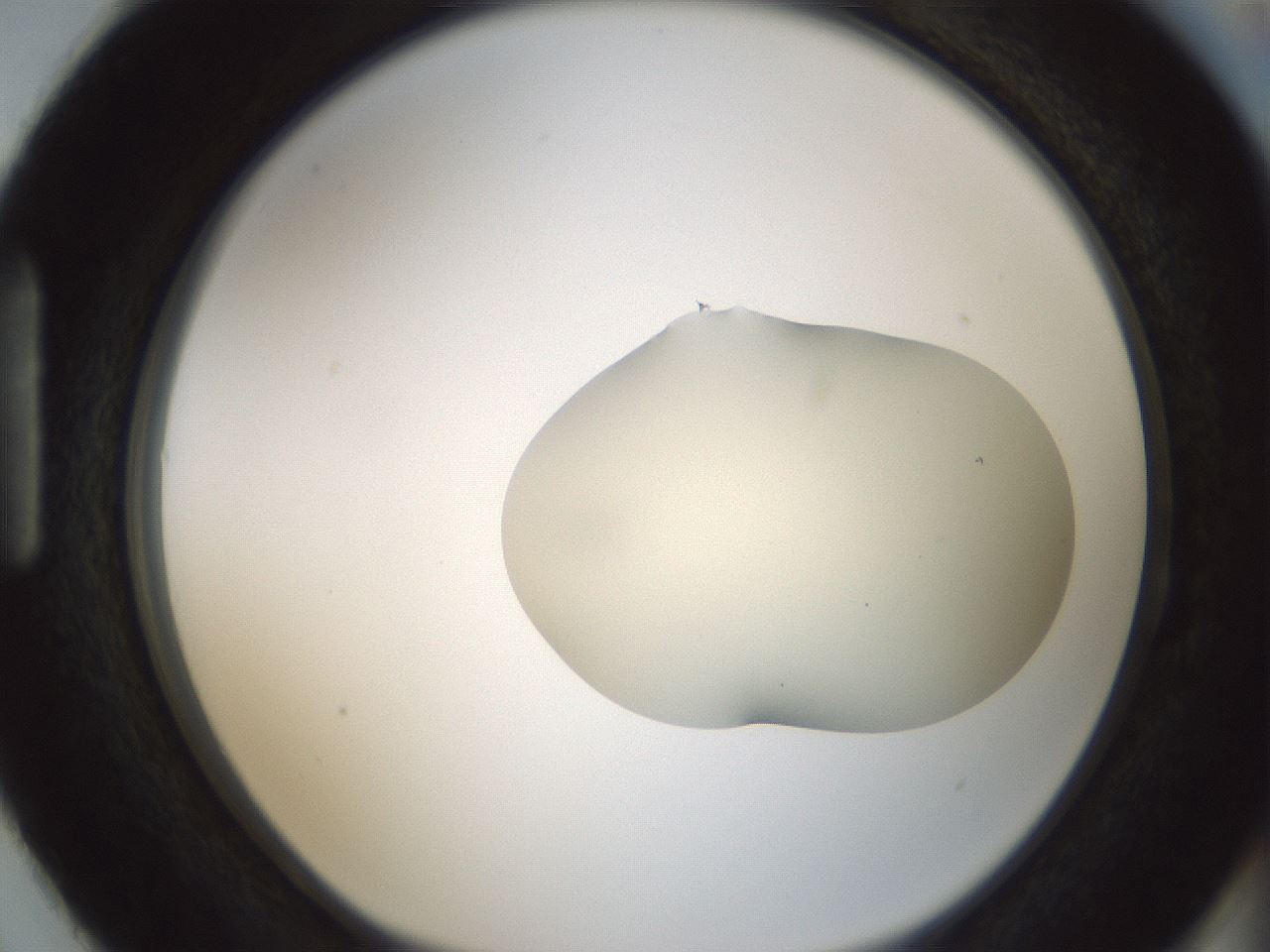 folderID541_plateID1541_batchID6247_wellNum87_profileID1_d1_r99520_ef.jpg