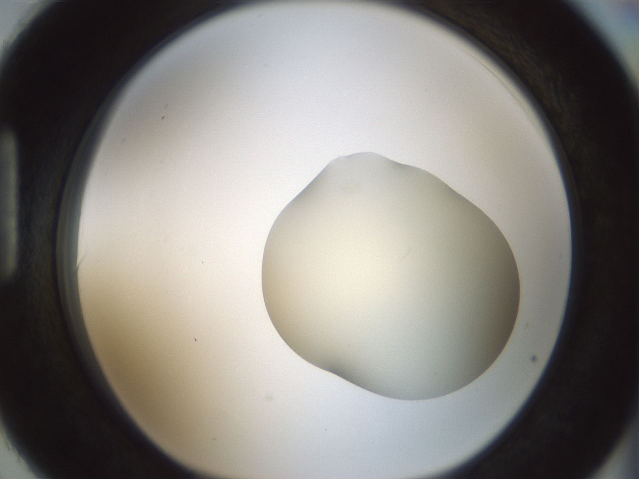 folderID541_plateID1541_batchID6247_wellNum90_profileID1_d1_r99523_ef.jpg