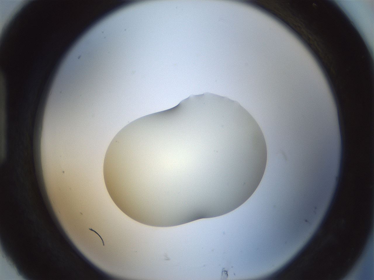 folderID541_plateID1541_batchID6247_wellNum92_profileID1_d1_r99525_ef.jpg