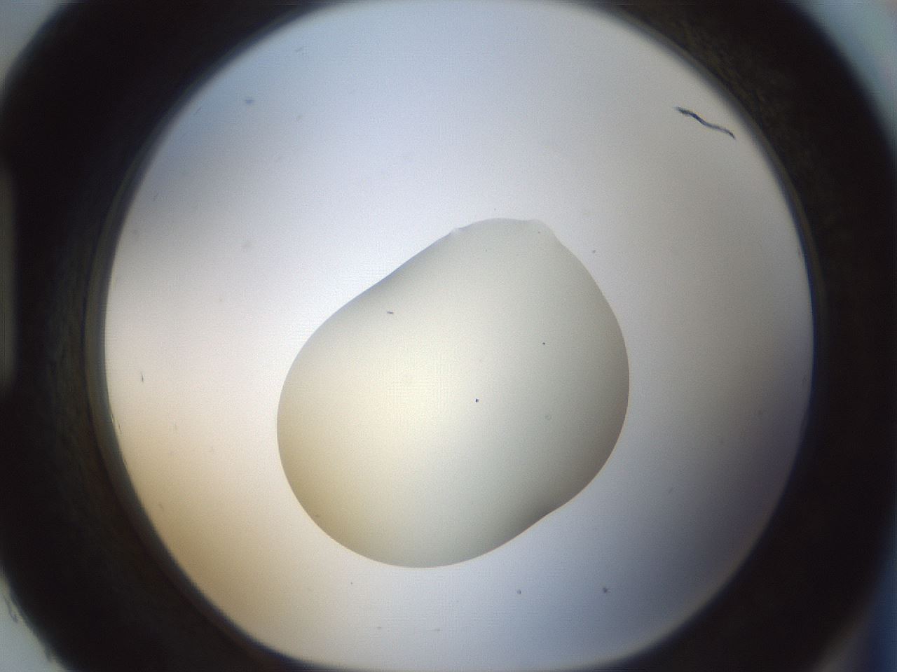 folderID541_plateID1541_batchID6247_wellNum93_profileID1_d1_r99526_ef.jpg