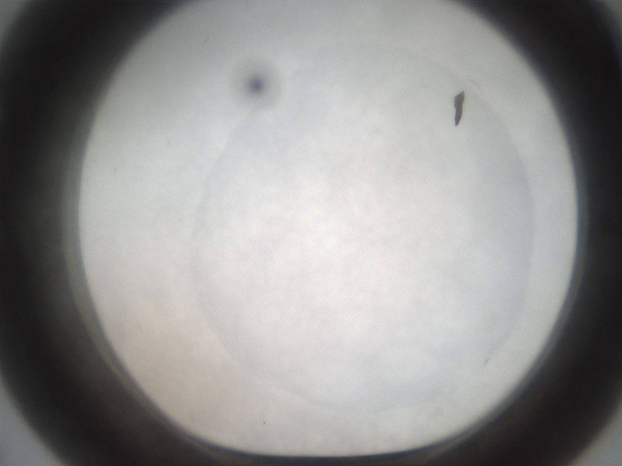 folderID555_plateID2555_batchID12621_wellNum55_profileID1_d1_r194899_ef.jpg