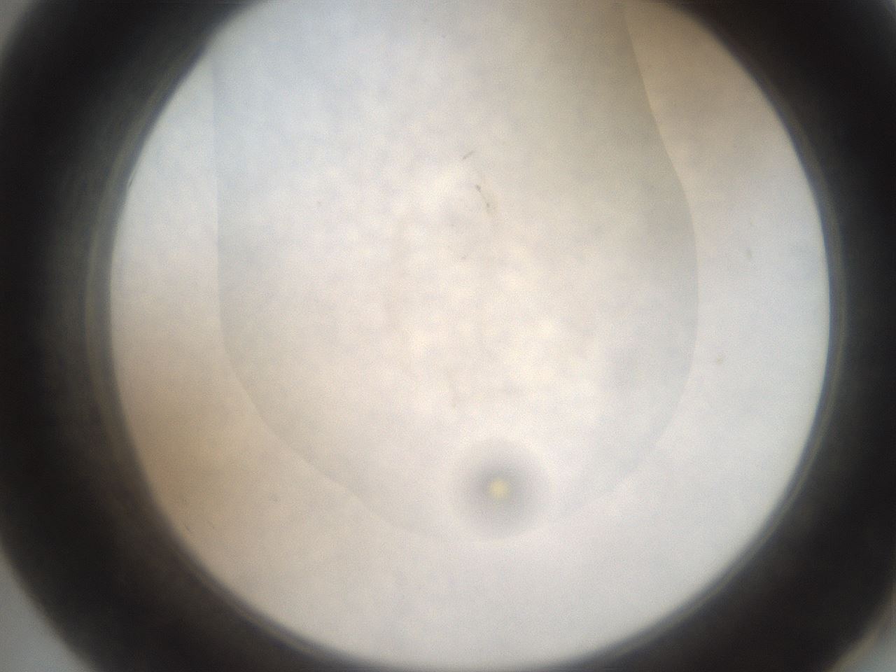 folderID555_plateID2555_batchID12621_wellNum55_profileID1_d2_r194900_ef.jpg