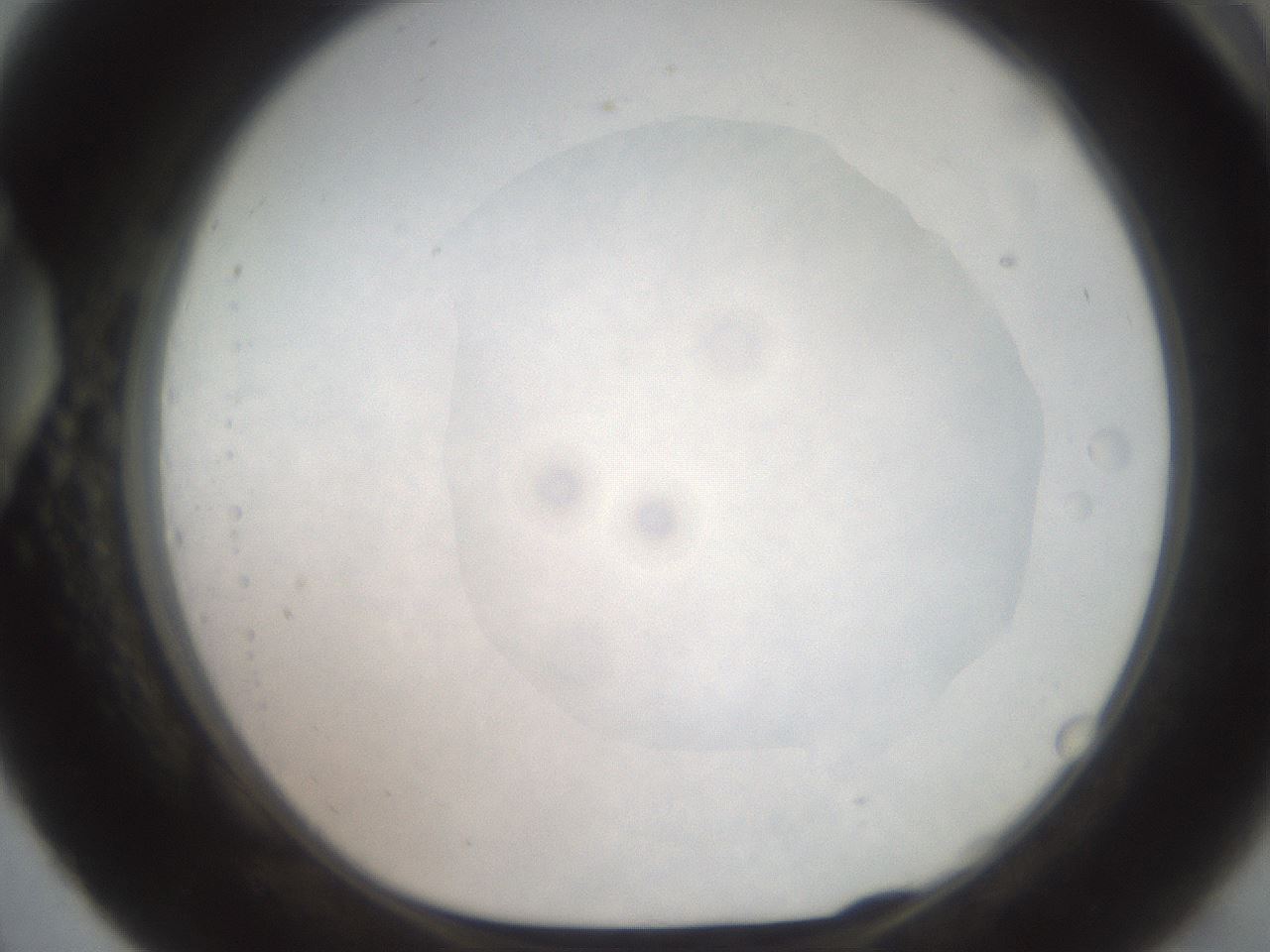 folderID555_plateID2555_batchID12621_wellNum56_profileID1_d1_r194901_ef.jpg