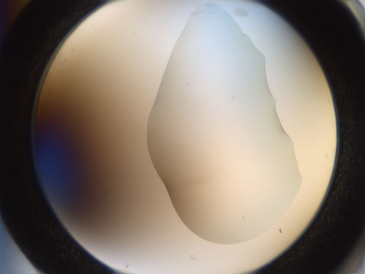 folderID555_plateID2555_batchID12621_wellNum85_profileID1_d2_r194960_ef.jpg