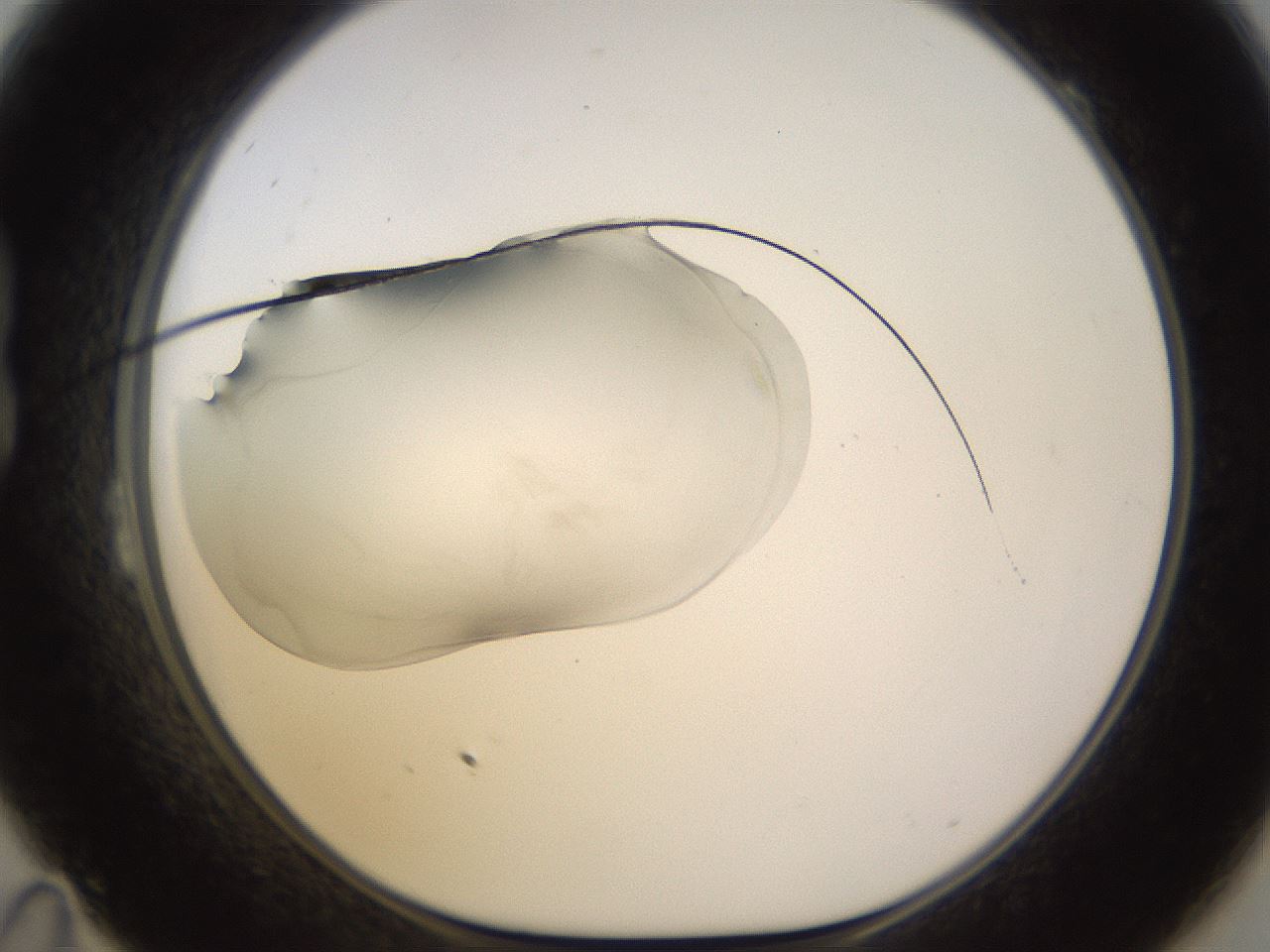 folderID566_plateID1566_batchID6313_wellNum23_profileID1_d1_r102250_ef.jpg