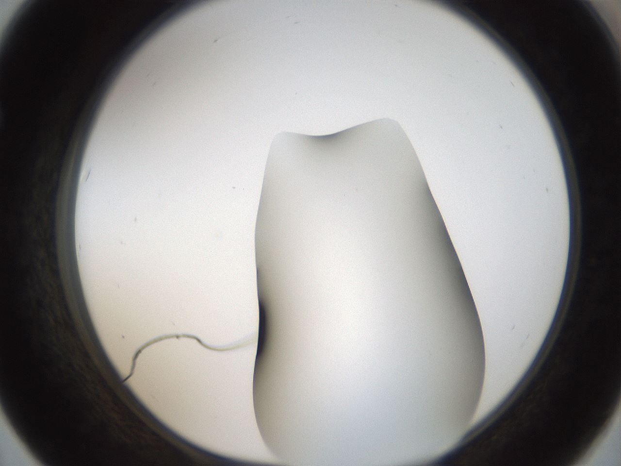 folderID56_plateID2056_batchID9023_wellNum67_profileID1_d1_r138681_ef.jpg