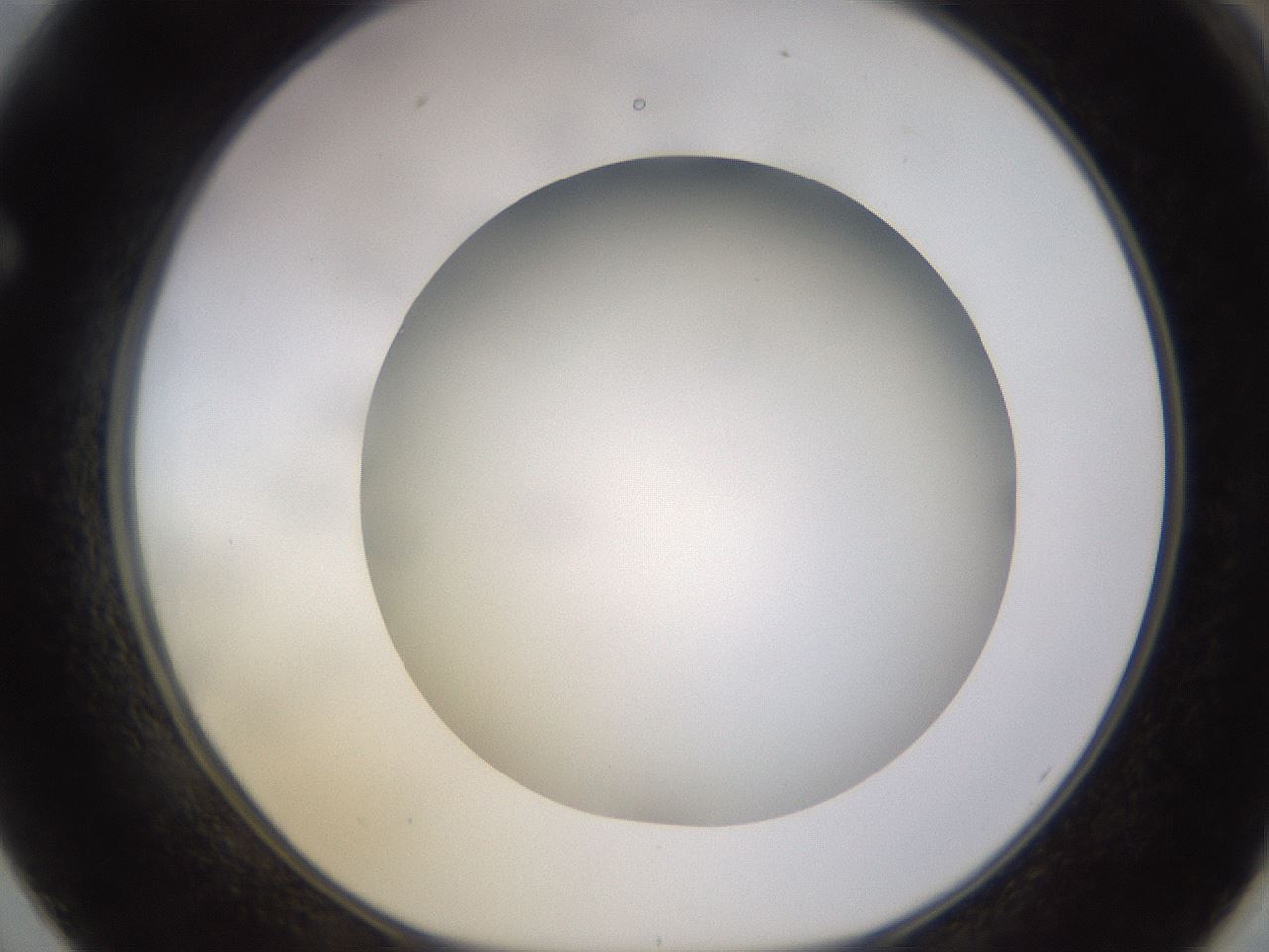folderID570_plateID1570_batchID6367_wellNum62_profileID1_d1_r102700_ef.jpg
