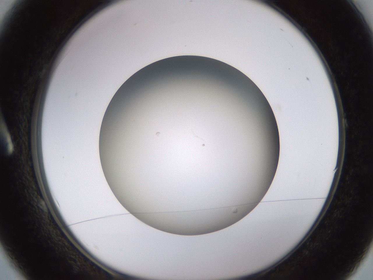 folderID570_plateID1570_batchID6376_wellNum1_profileID1_d1_r102639_ef.jpg