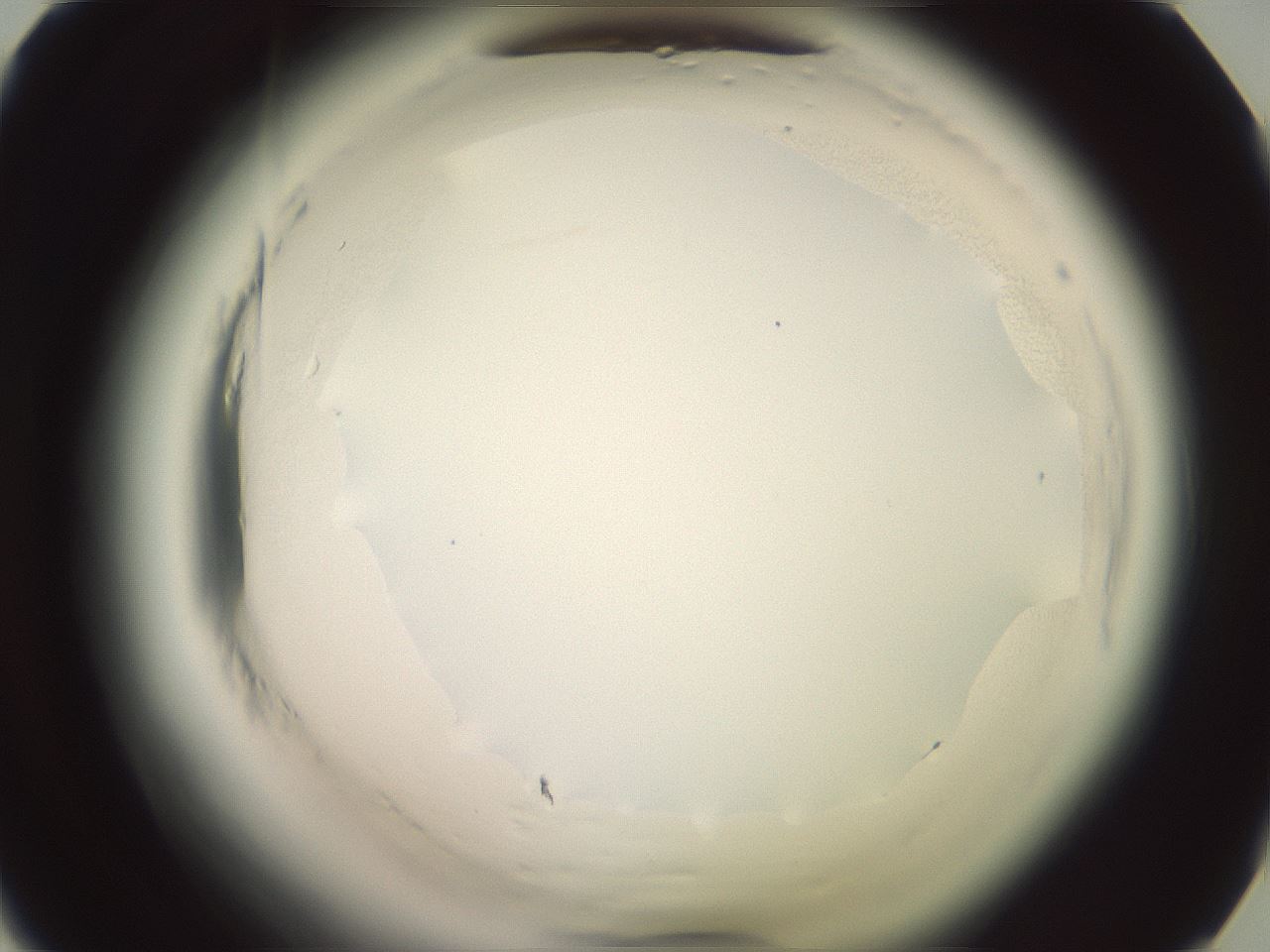 folderID576_plateID2576_batchID13156_wellNum38_profileID1_d1_r197688_ef.jpg