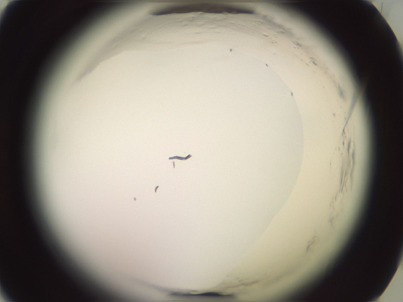 folderID577_plateID2577_batchID13160_wellNum25_profileID1_d1_r198513_ef.jpg