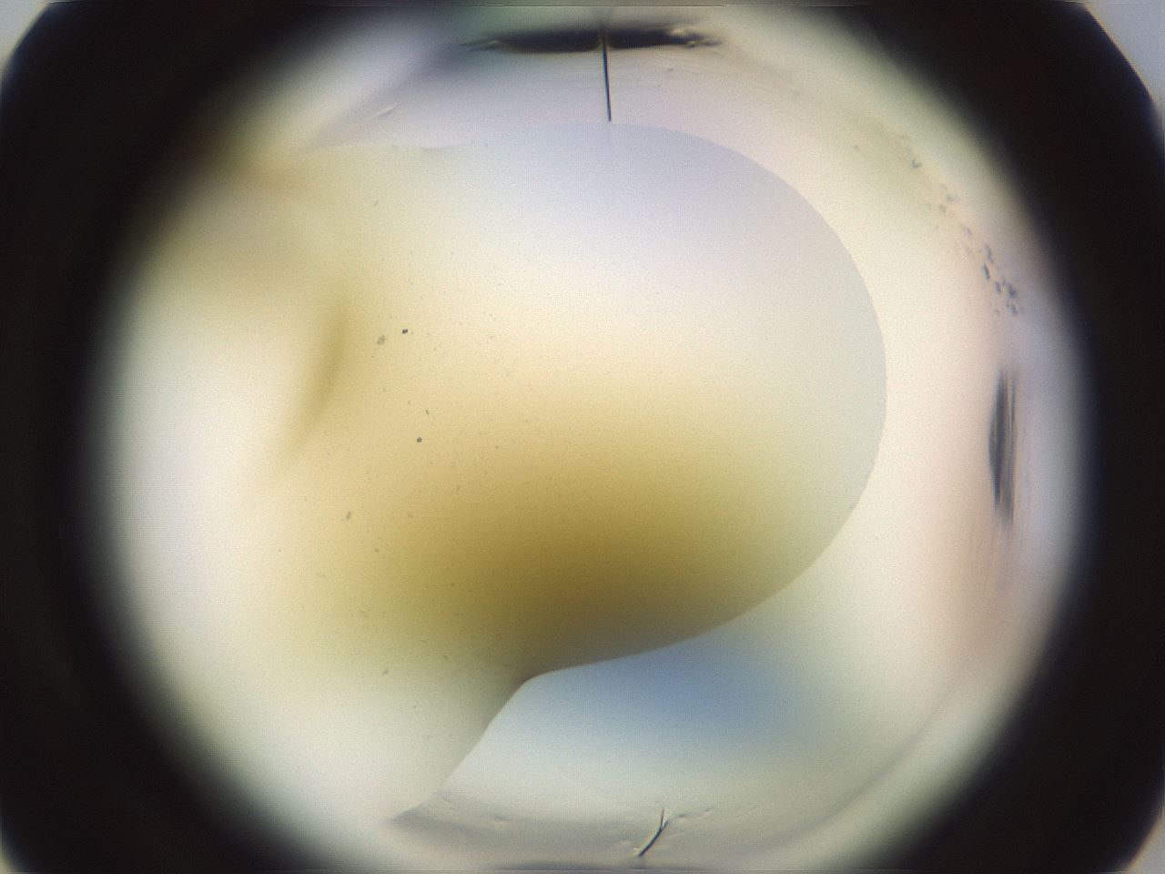 folderID577_plateID2577_batchID13160_wellNum5_profileID1_d3_r198455_ef.jpg