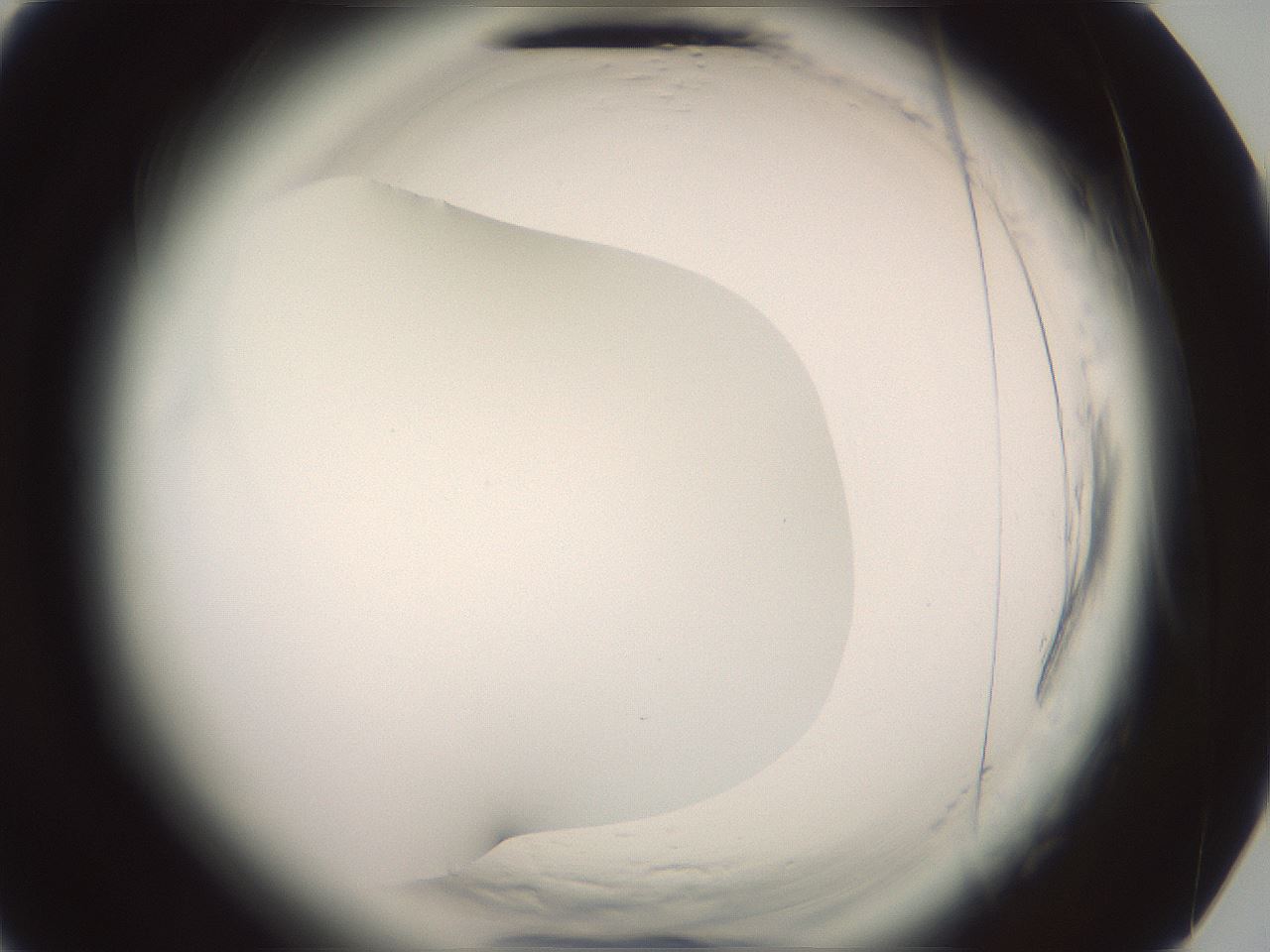 folderID577_plateID2577_batchID13160_wellNum75_profileID1_d3_r198665_ef.jpg