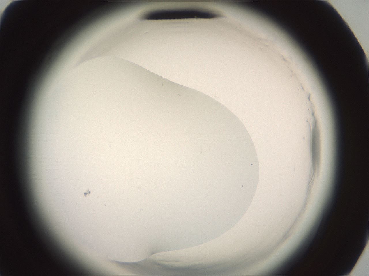 folderID577_plateID2577_batchID13160_wellNum79_profileID1_d3_r198677_ef.jpg