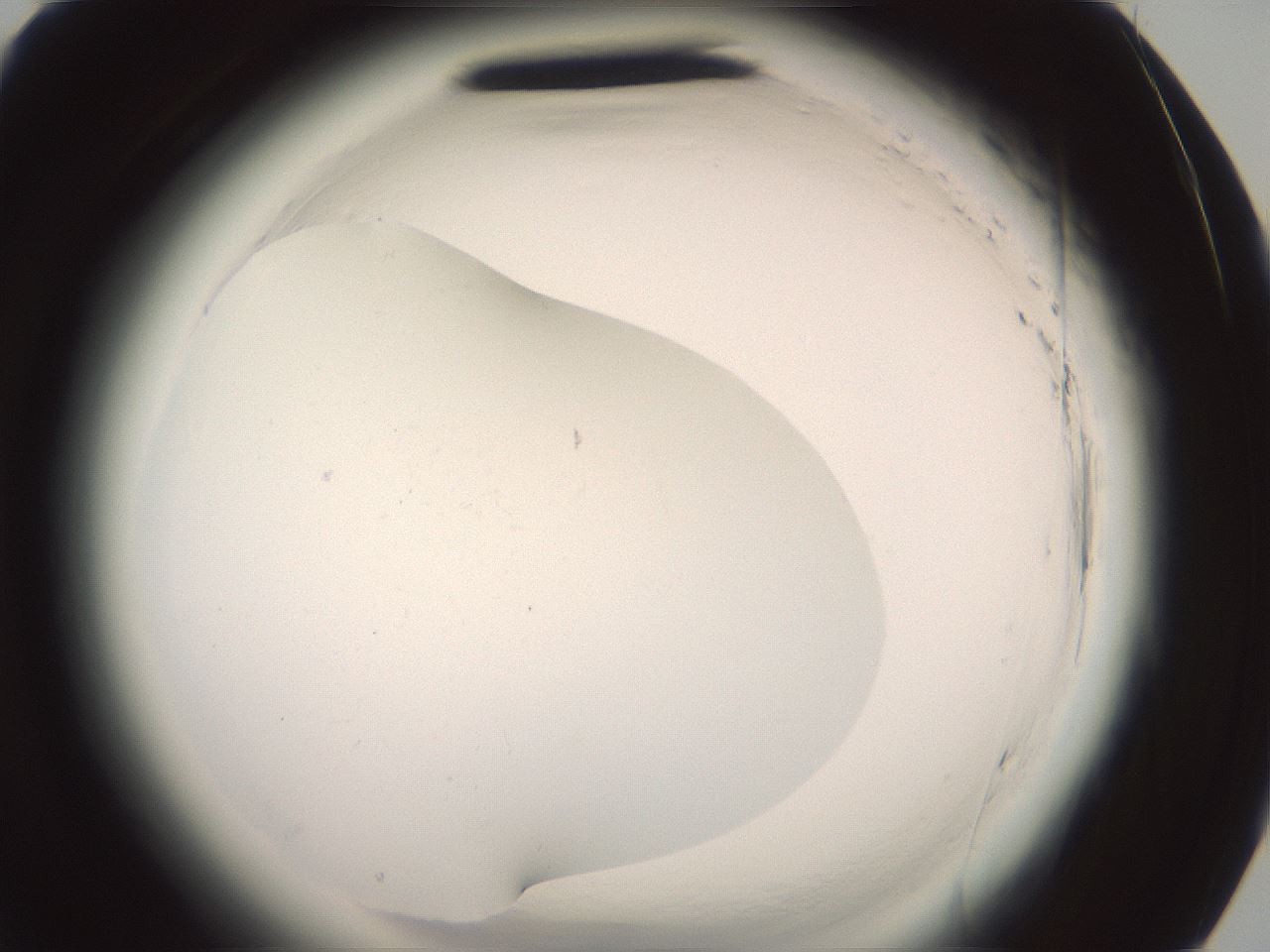 folderID577_plateID2577_batchID13160_wellNum81_profileID1_d3_r198683_ef.jpg