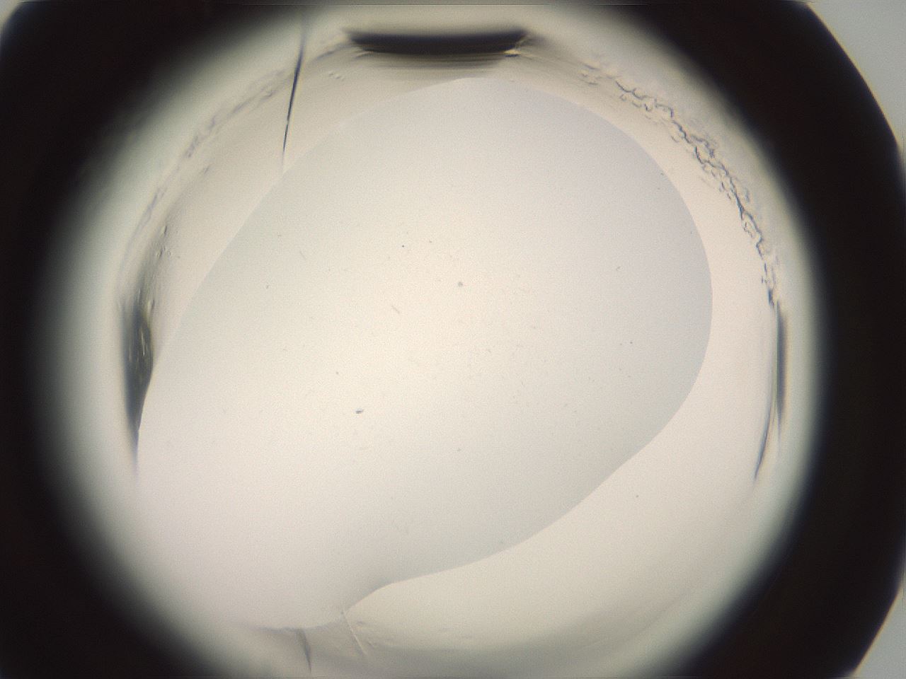 folderID577_plateID2577_batchID13160_wellNum90_profileID1_d3_r198710_ef.jpg