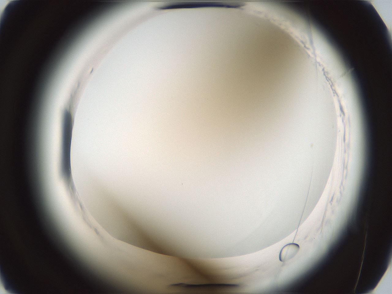 folderID585_plateID2585_batchID13185_wellNum15_profileID1_d2_r205109_ef.jpg