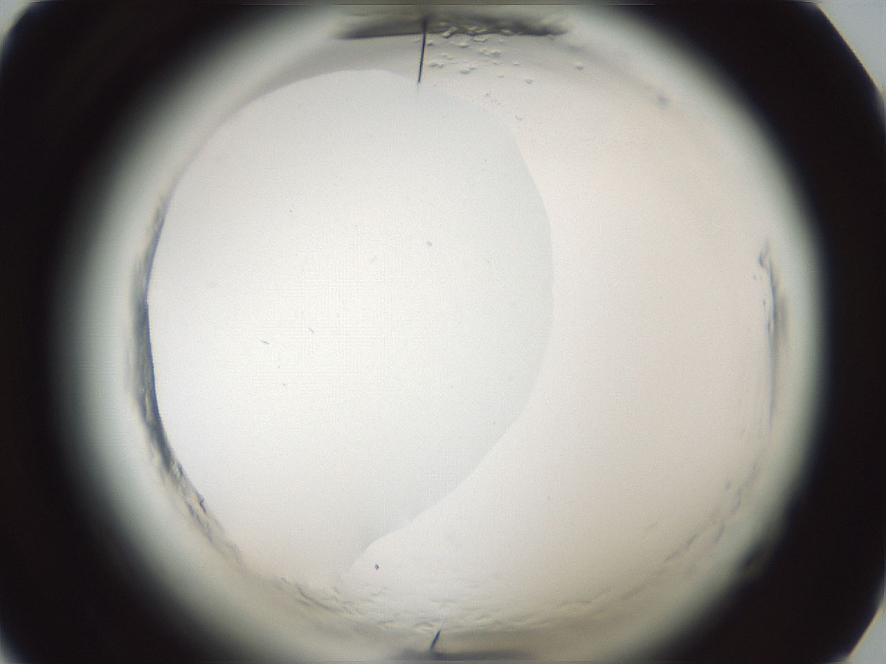 folderID585_plateID2585_batchID13185_wellNum28_profileID1_d1_r205147_ef.jpg
