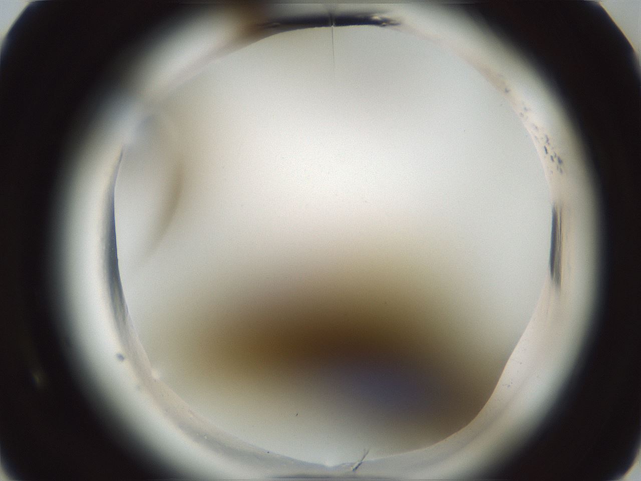 folderID585_plateID2585_batchID13185_wellNum5_profileID1_d3_r205080_ef.jpg