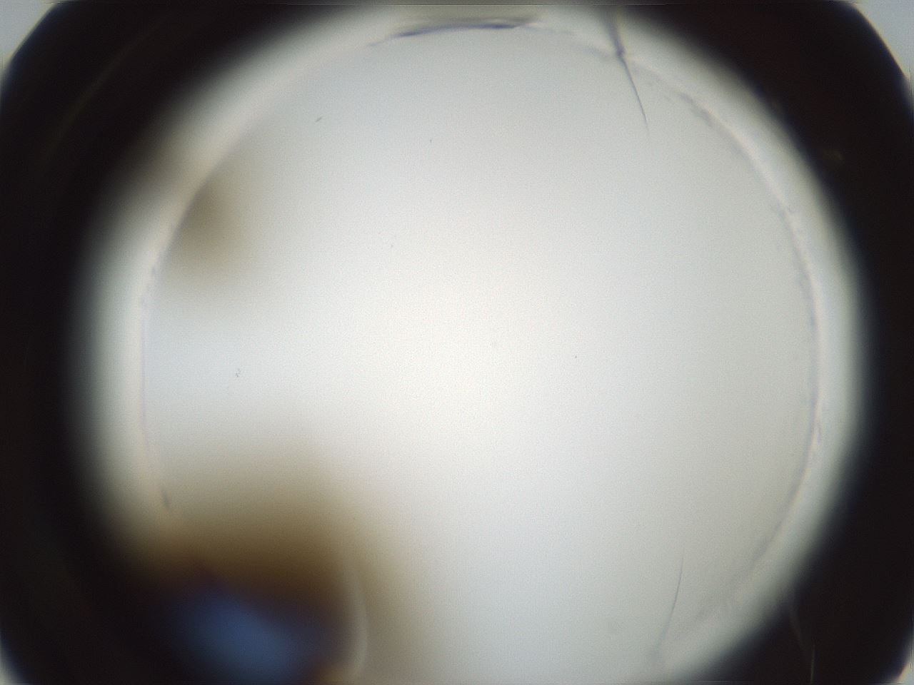 folderID585_plateID2585_batchID13185_wellNum22_profileID1_d2_r205130_ef.jpg