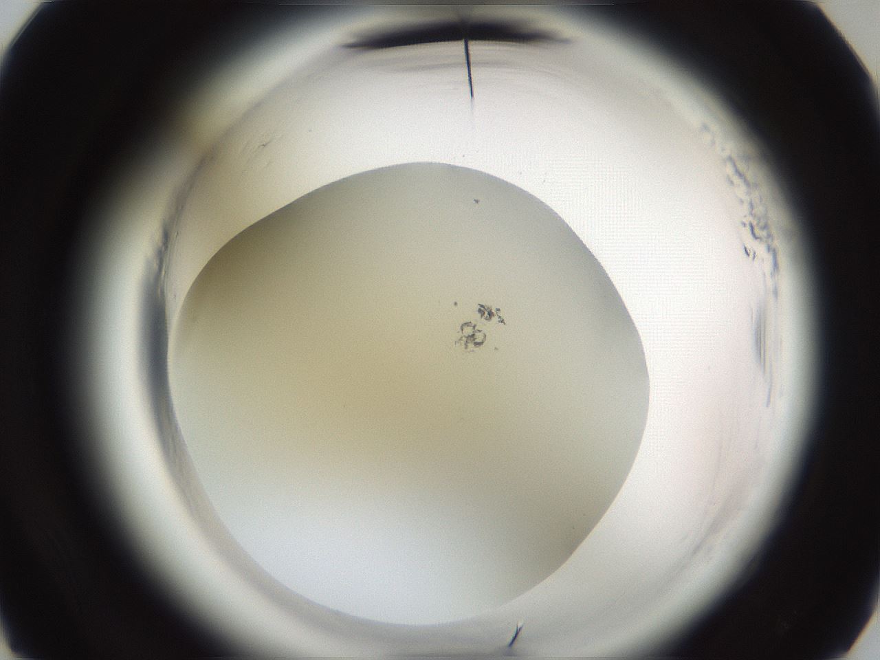 folderID587_plateID2587_batchID13159_wellNum17_profileID1_d3_r197915_ef.jpg