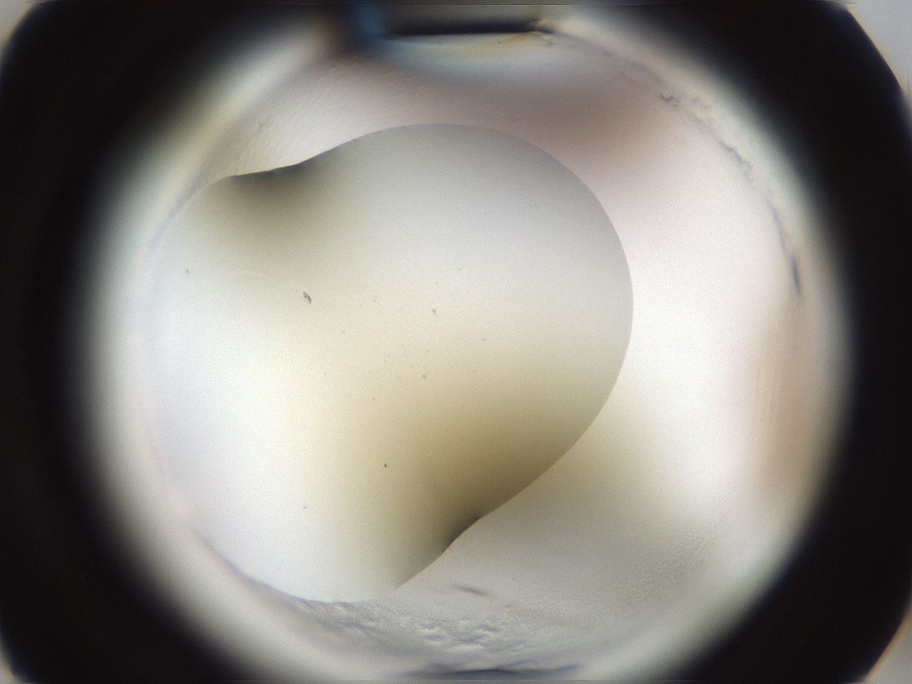 folderID587_plateID2587_batchID13159_wellNum3_profileID1_d3_r197873_ef.jpg