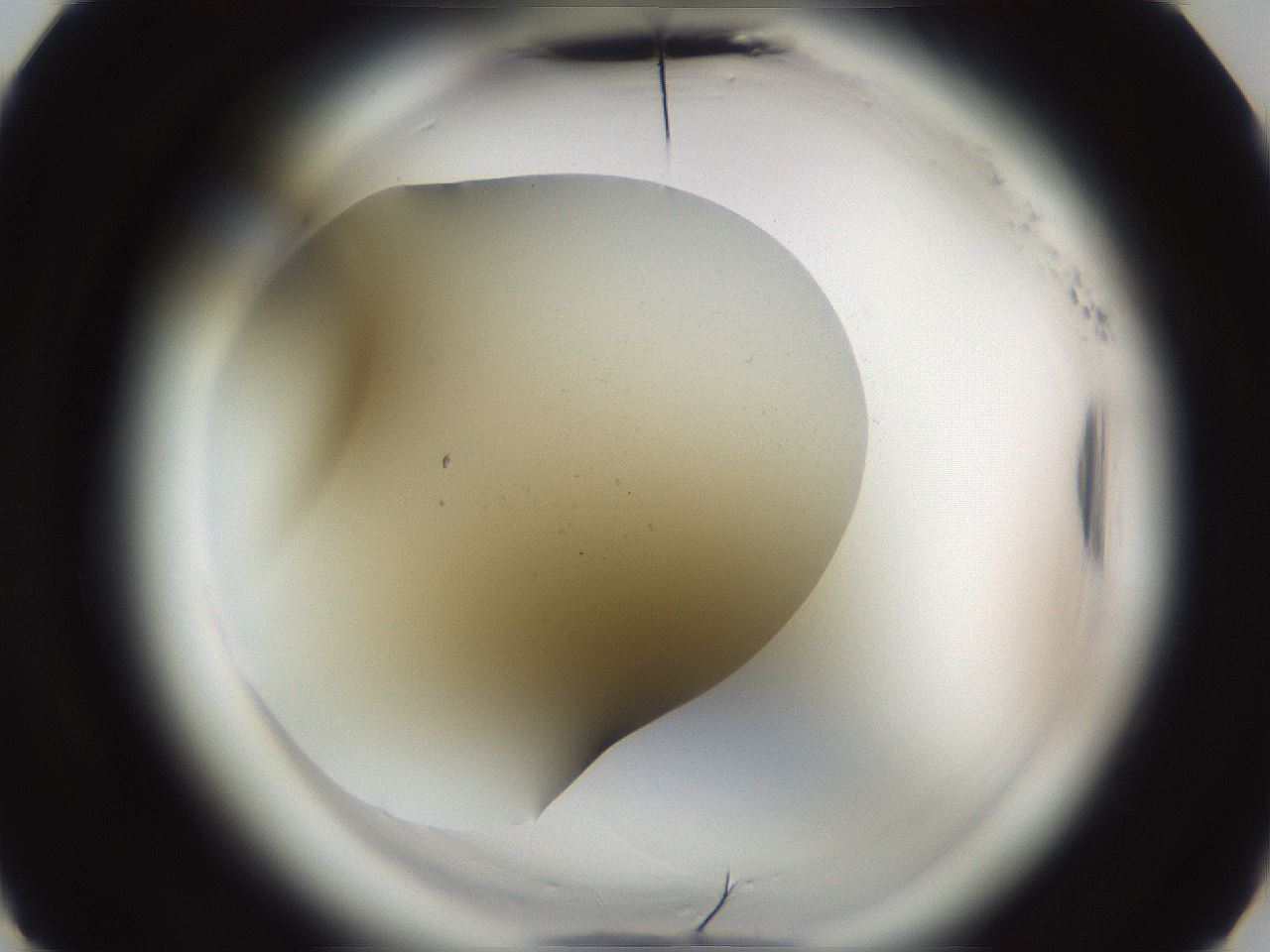 folderID587_plateID2587_batchID13159_wellNum5_profileID1_d3_r197879_ef.jpg