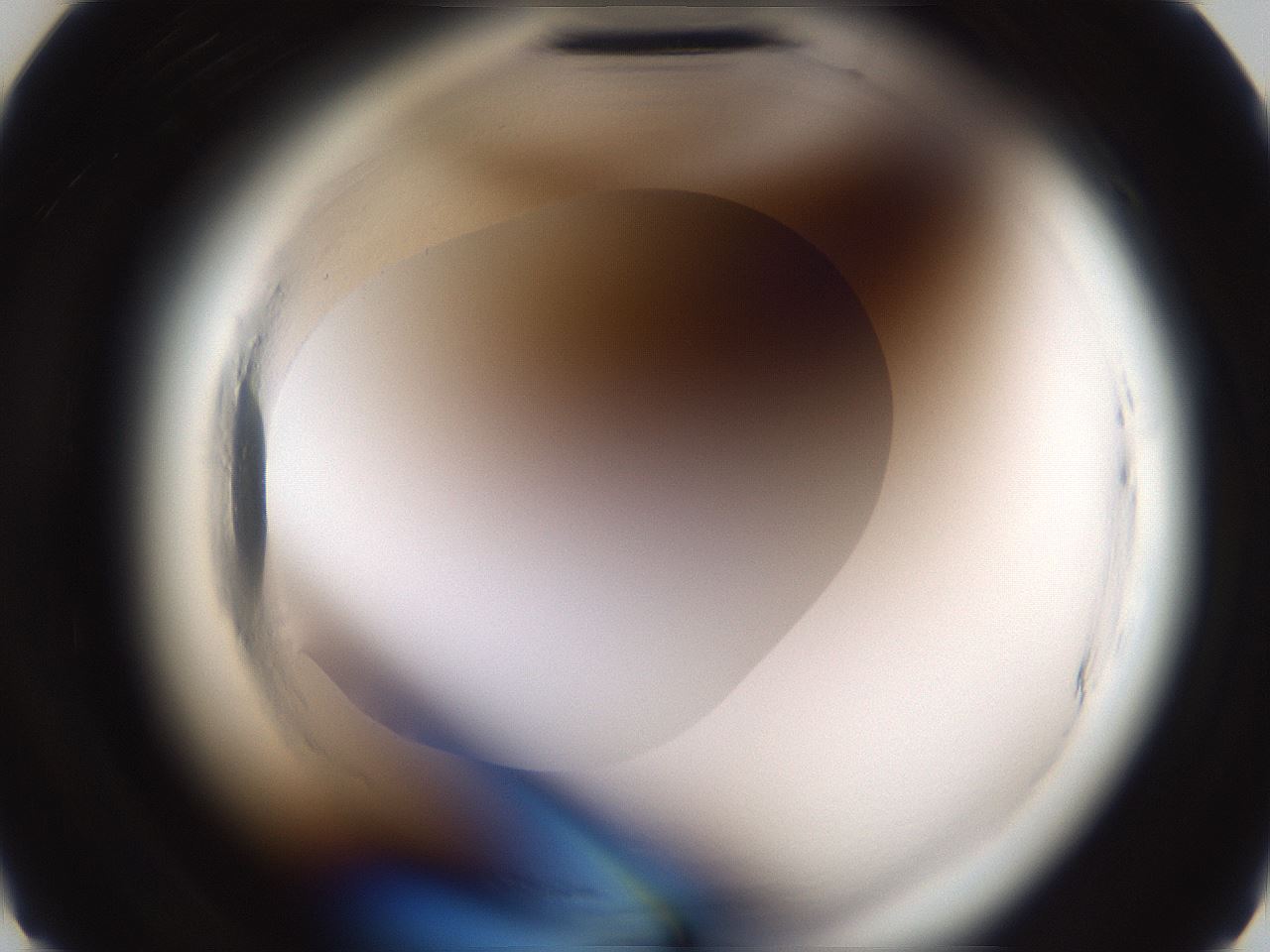 folderID587_plateID2587_batchID13159_wellNum8_profileID1_d2_r197887_ef.jpg