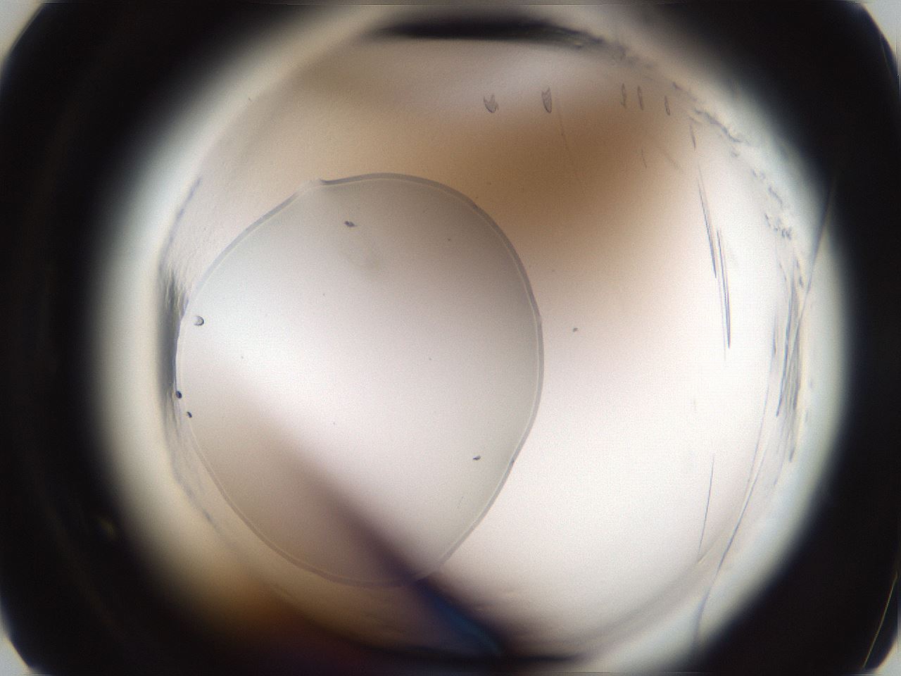 folderID588_plateID2588_batchID13162_wellNum6_profileID1_d2_r199033_ef.jpg