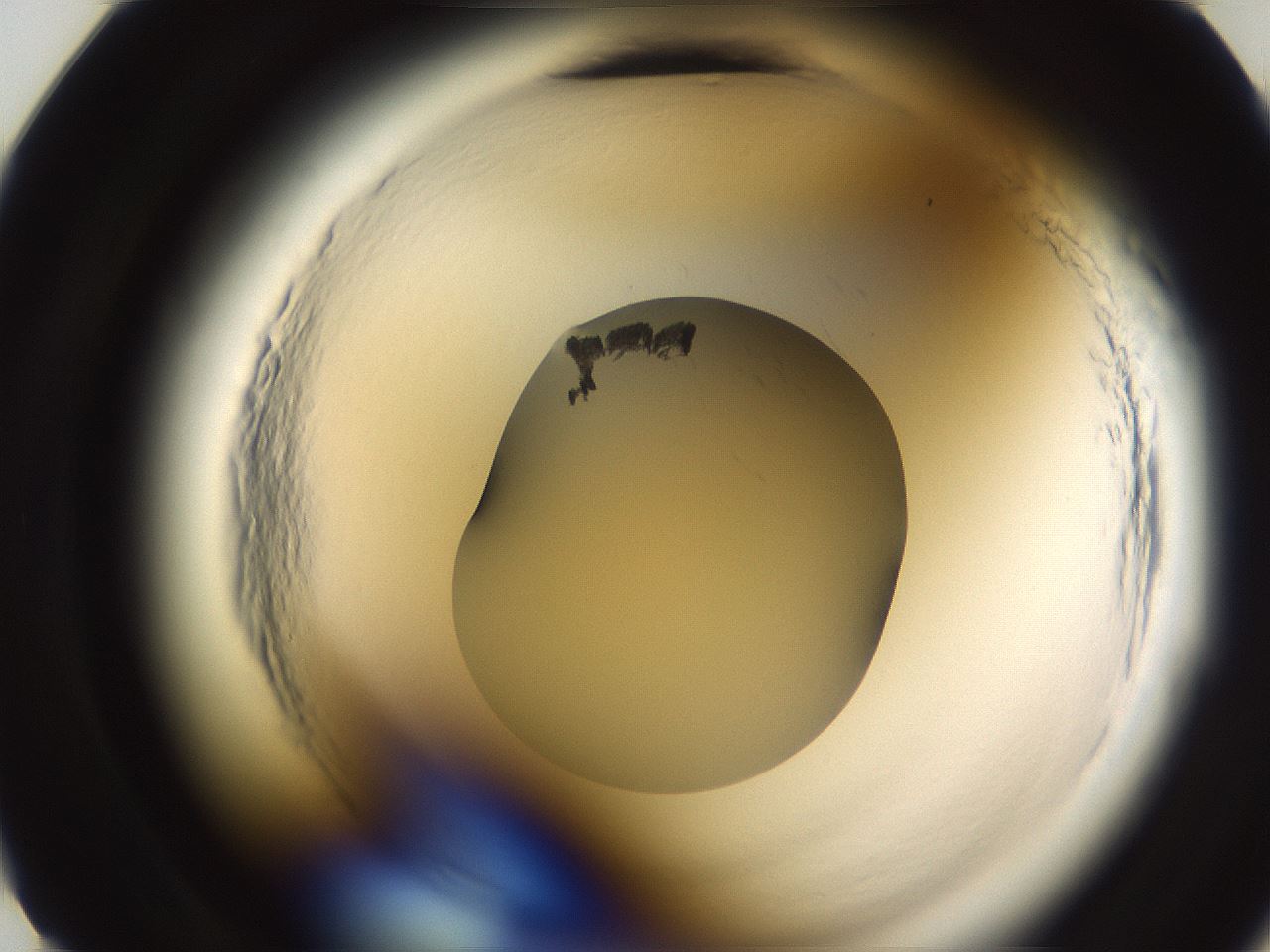 folderID589_plateID2589_batchID13167_wellNum11_profileID1_d2_r200200_ef.jpg