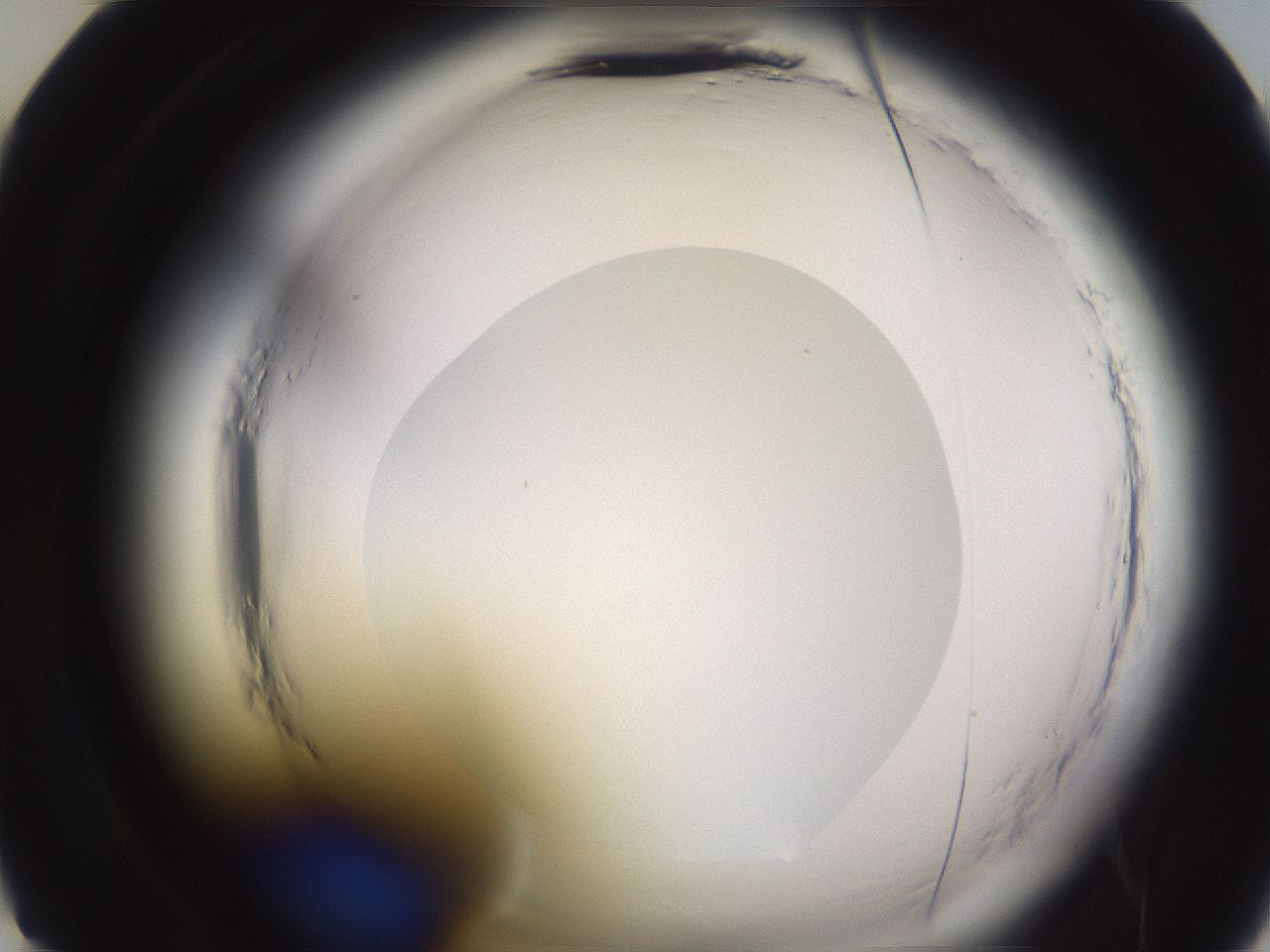 folderID589_plateID2589_batchID13167_wellNum22_profileID1_d2_r200233_ef.jpg