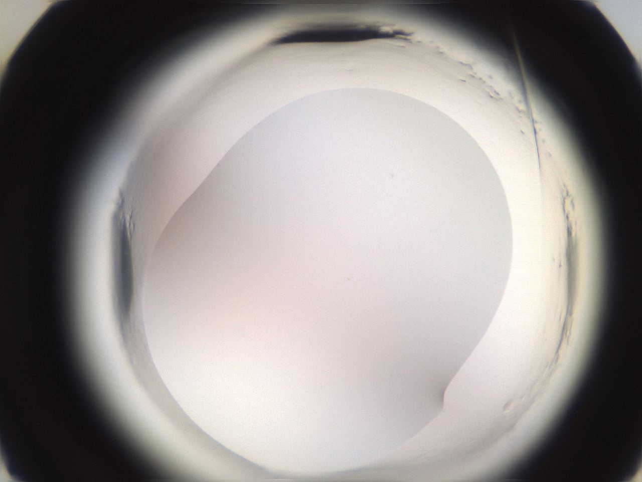 folderID589_plateID2589_batchID13167_wellNum22_profileID1_d3_r200234_ef.jpg