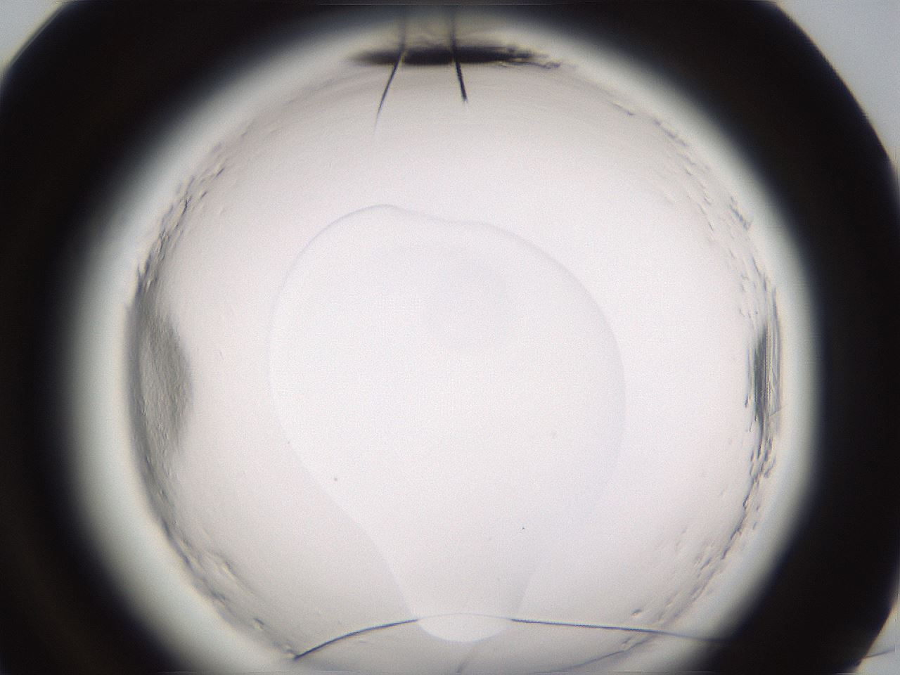 folderID589_plateID2589_batchID13167_wellNum96_profileID1_d3_r200456_ef.jpg